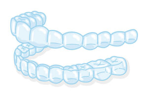 マウスピースのメリットについて